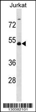 WTAP Antibody