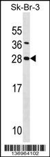 SDC4 Antibody