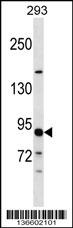 TUBGCP3 Antibody