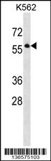 SEPT8 Antibody