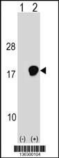 UBE2D3 Antibody