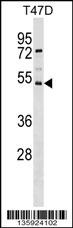 SVOPL Antibody