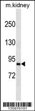 SEMA4A Antibody