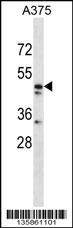 ZPR1 Antibody