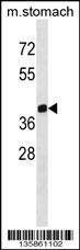 ZPR1 Antibody