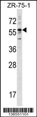 KRT3 Antibody