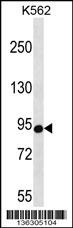 CSDE1 Antibody