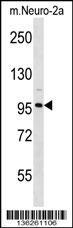 CLCN2 Antibody