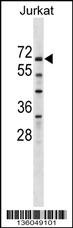 ZSCAN25 Antibody