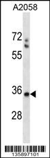 SPEM1 Antibody