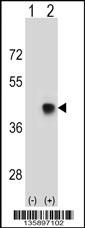 SPEM1 Antibody