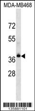 LPAR4 Antibody