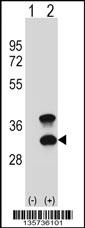 CD79B Antibody