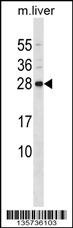 CD79B Antibody