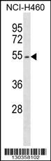 EPOR Antibody