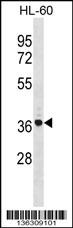 TNIP2 Antibody