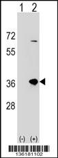 SULT1B1 Antibody