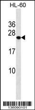 PCTP Antibody