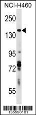 DIAPH3 Antibody