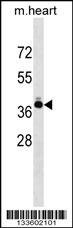 TNNT2 Antibody
