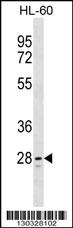 TLCD1 Antibody