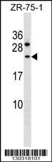 CCDC140 Antibody