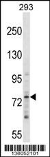 ZNF81 Antibody