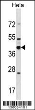DND1 Antibody
