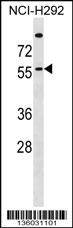 ZDHHC13 Antibody