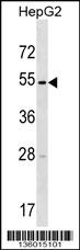 TMPRSS11E Antibody