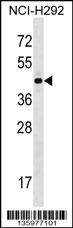 ZNF436 Antibody