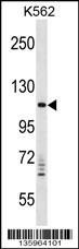 VPS11 Antibody