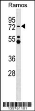 MTA3 Antibody