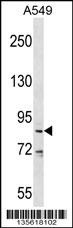DDX53 Antibody