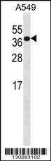 HOXD4 Antibody