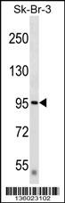 DTX3L Antibody