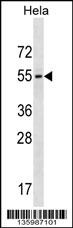 GALR3 Antibody