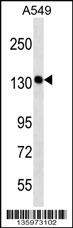 PDS5A Antibody