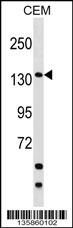 SAFB2 Antibody