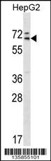 MED26 Antibody