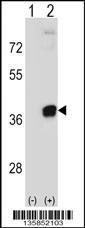 PRPS2 Antibody