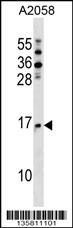 NAA20 Antibody