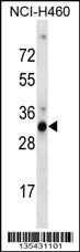 OR9G4 Antibody