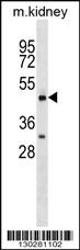 HCRTR2 Antibody