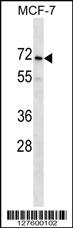 PRAMEF2 Antibody