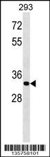ELOVL4 Antibody