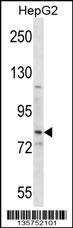 SMO Antibody