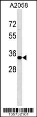 ZNF570 Antibody