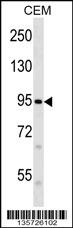 PIEZO2 Antibody