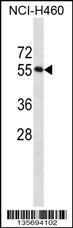 RBM45 Antibody